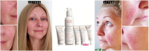 Rosacea Reviews: Avene Antirougeurs & La Roche-Posay Rosaliac