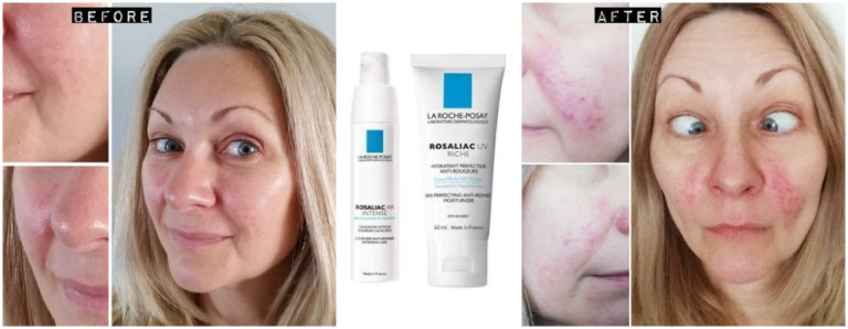 Rosacea Reviews: Avene Antirougeurs & La Roche-Posay Rosaliac