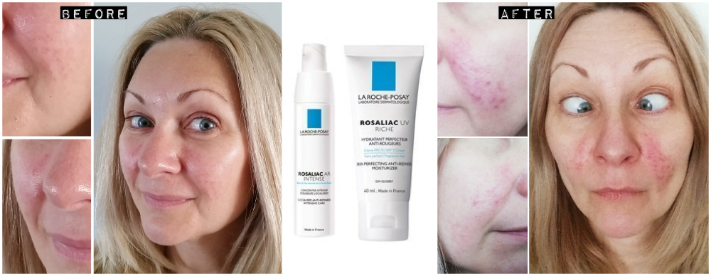 Which La Roche-Posay is good for rosacea?